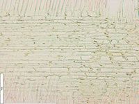 Radial section